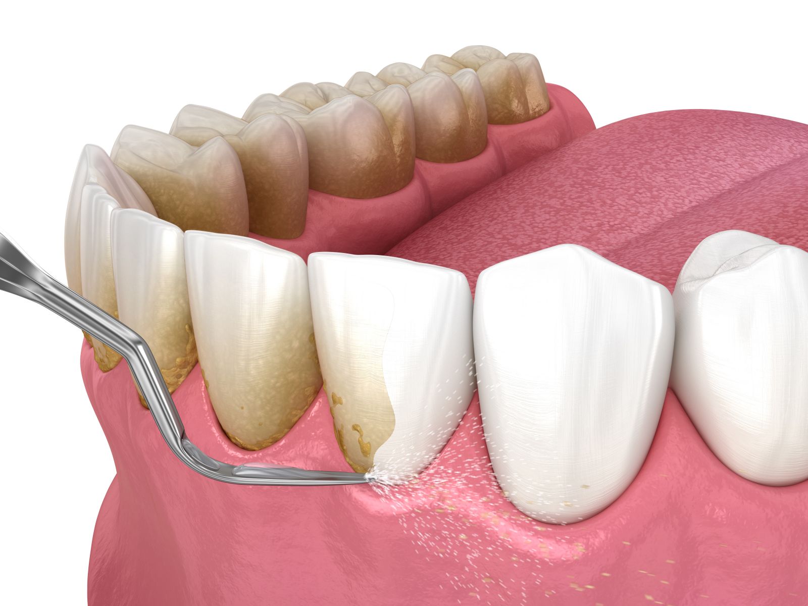 Sz jhigi nia fog elt vol t s Bart k Dental Fog szat Budapest